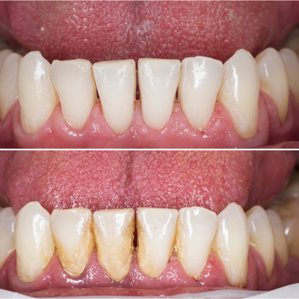 on going dental issues full mouth reconstruction services