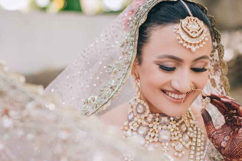 wedding smile makeover treatments