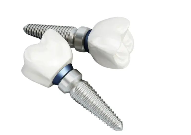 Dental implants