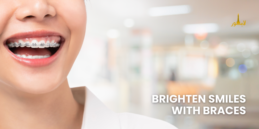 Teeth Whitening with braces BLOG 1