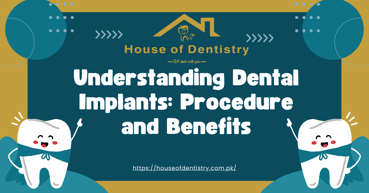 Dental Implants