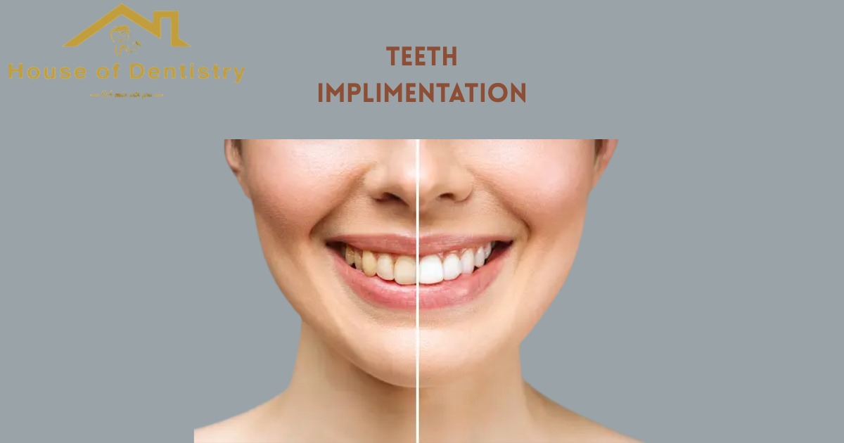 Teeth Procreation Cost