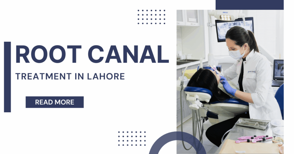 Root Canal Treatment in Lahore