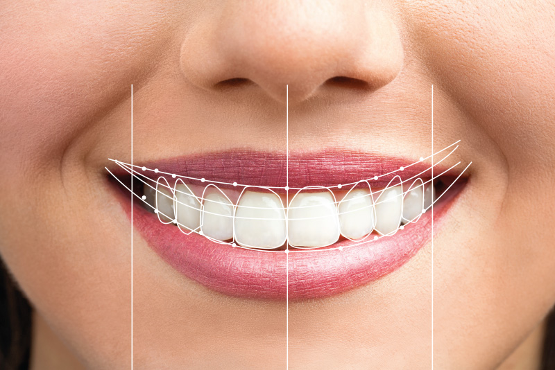 smile prev 800