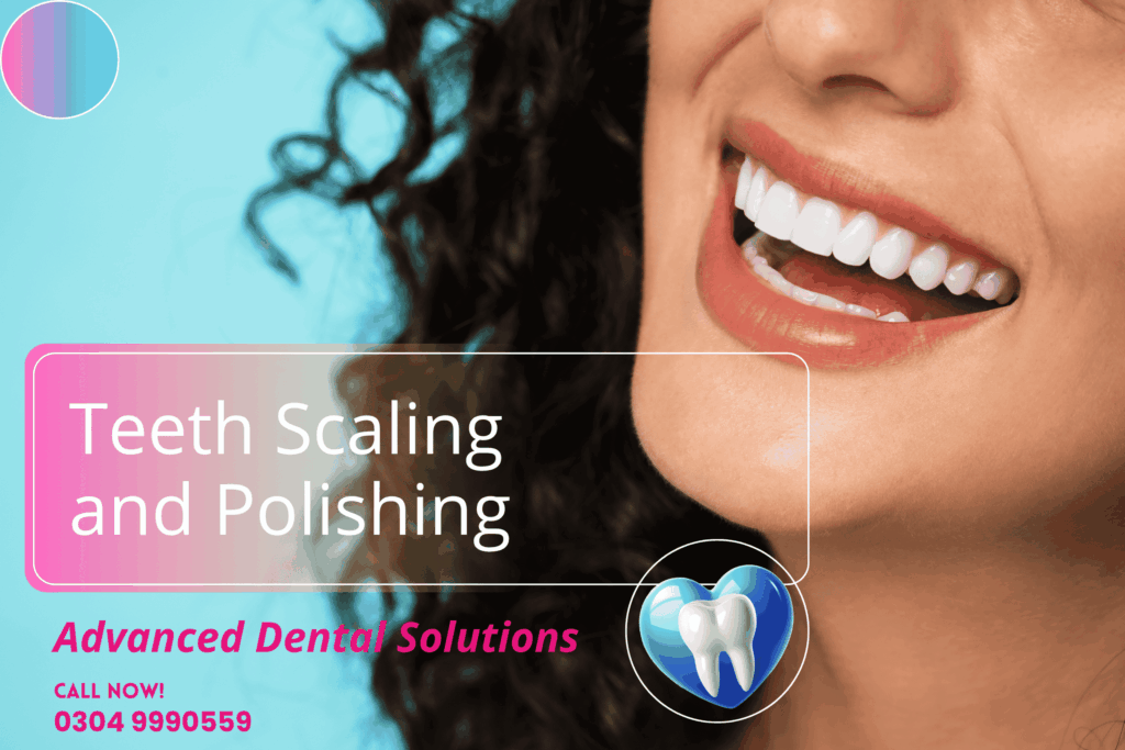 Teeth Scaling and Polishing in Lahore