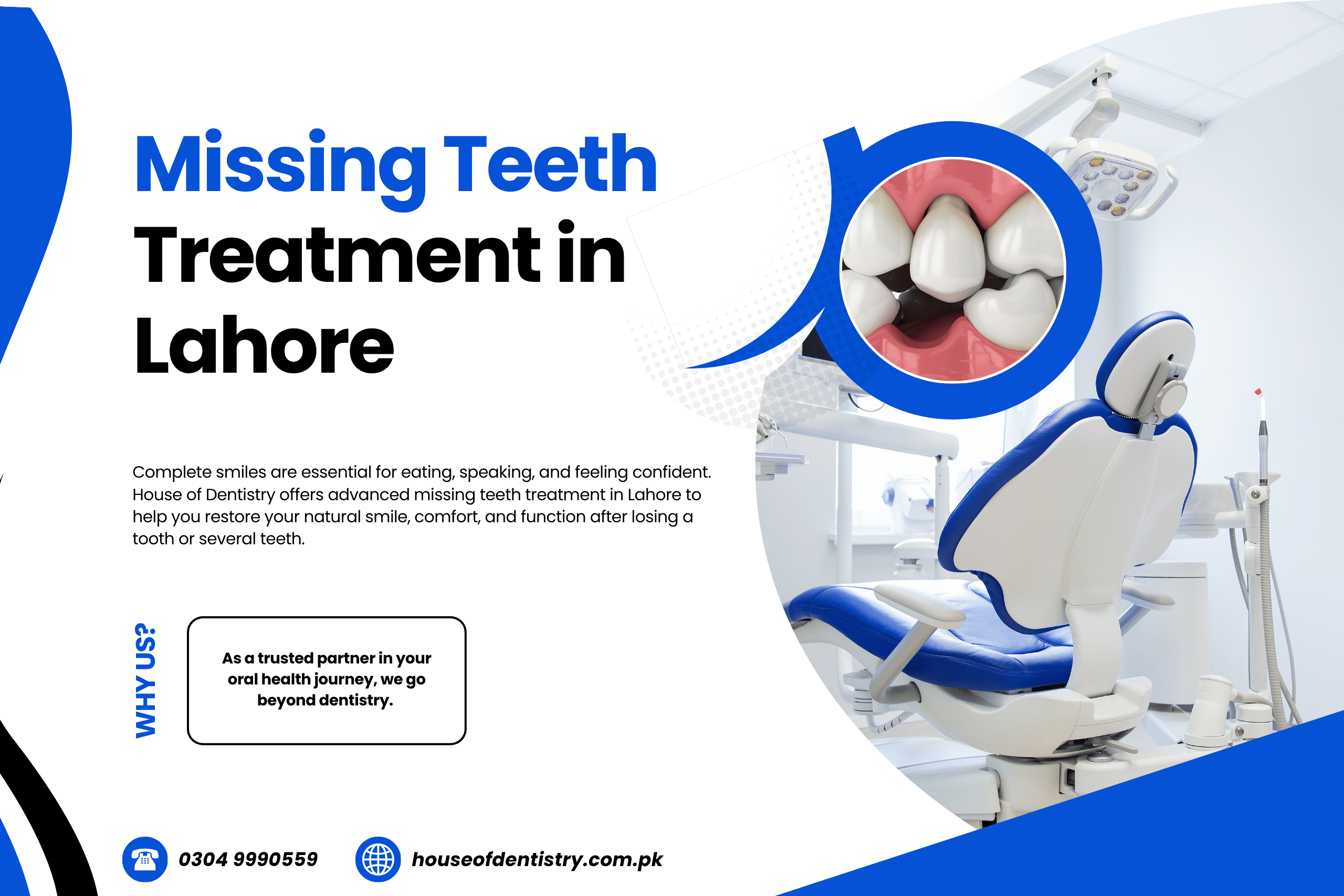 Missing Teeth Treatment in Lahore
