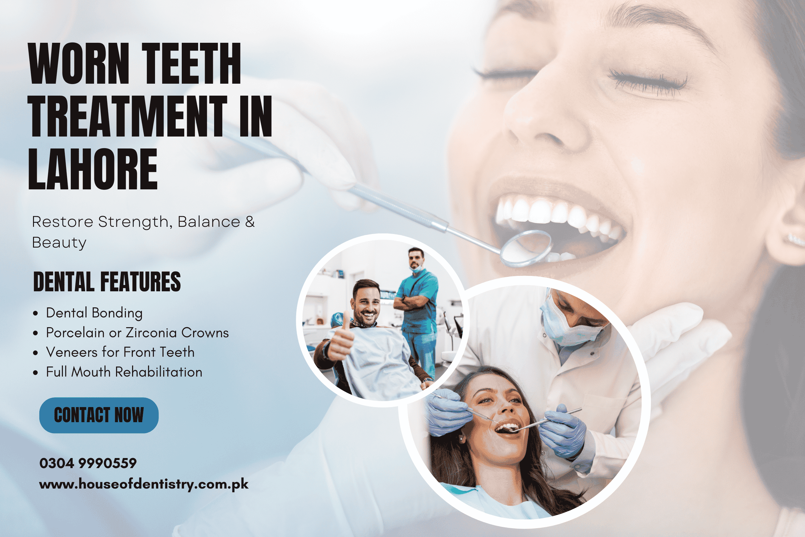 Worn Teeth Treatment