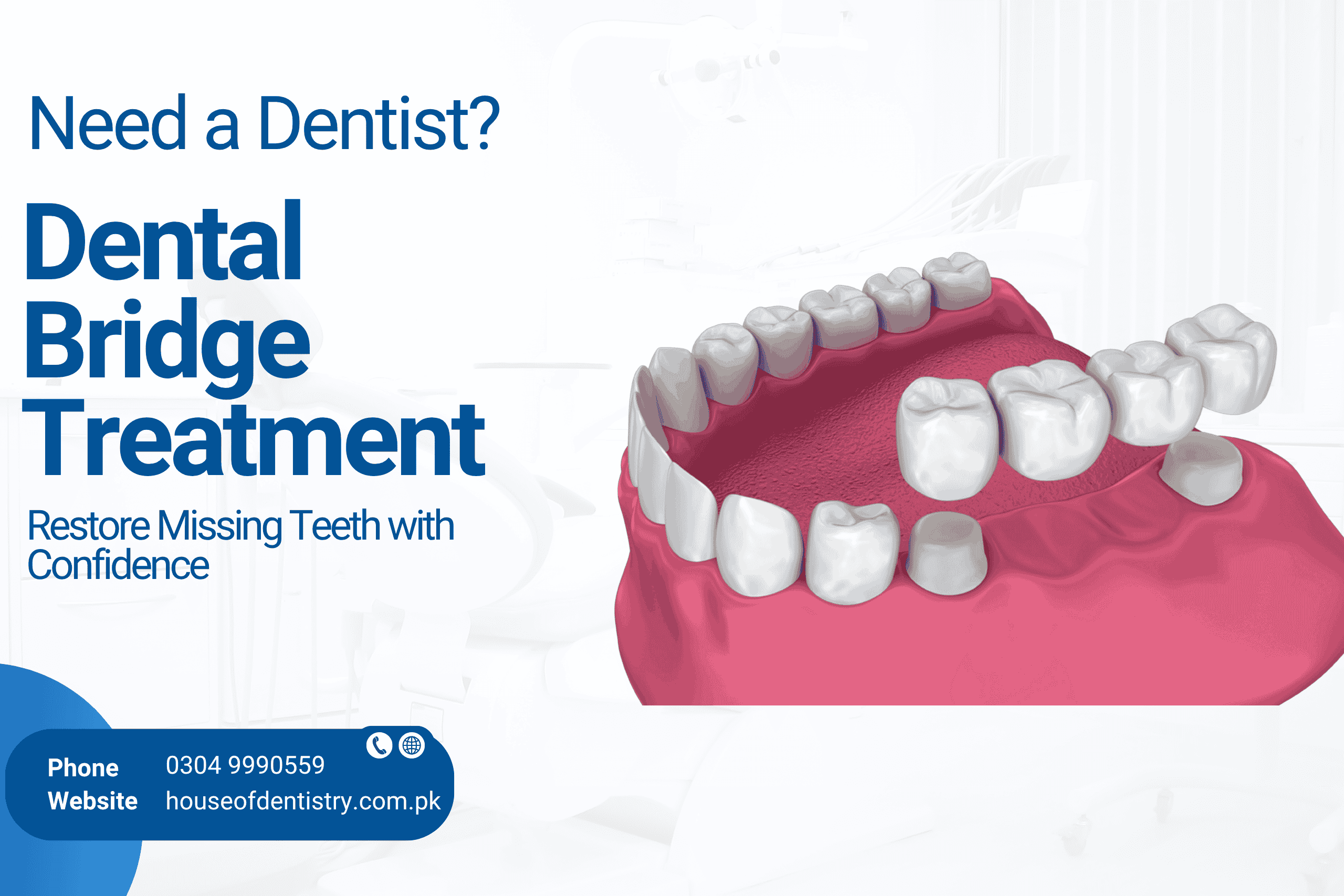 Dental Bridge Treatment in Lahore