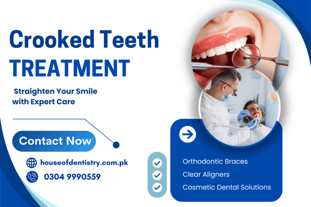 Crooked Teeth Treatment