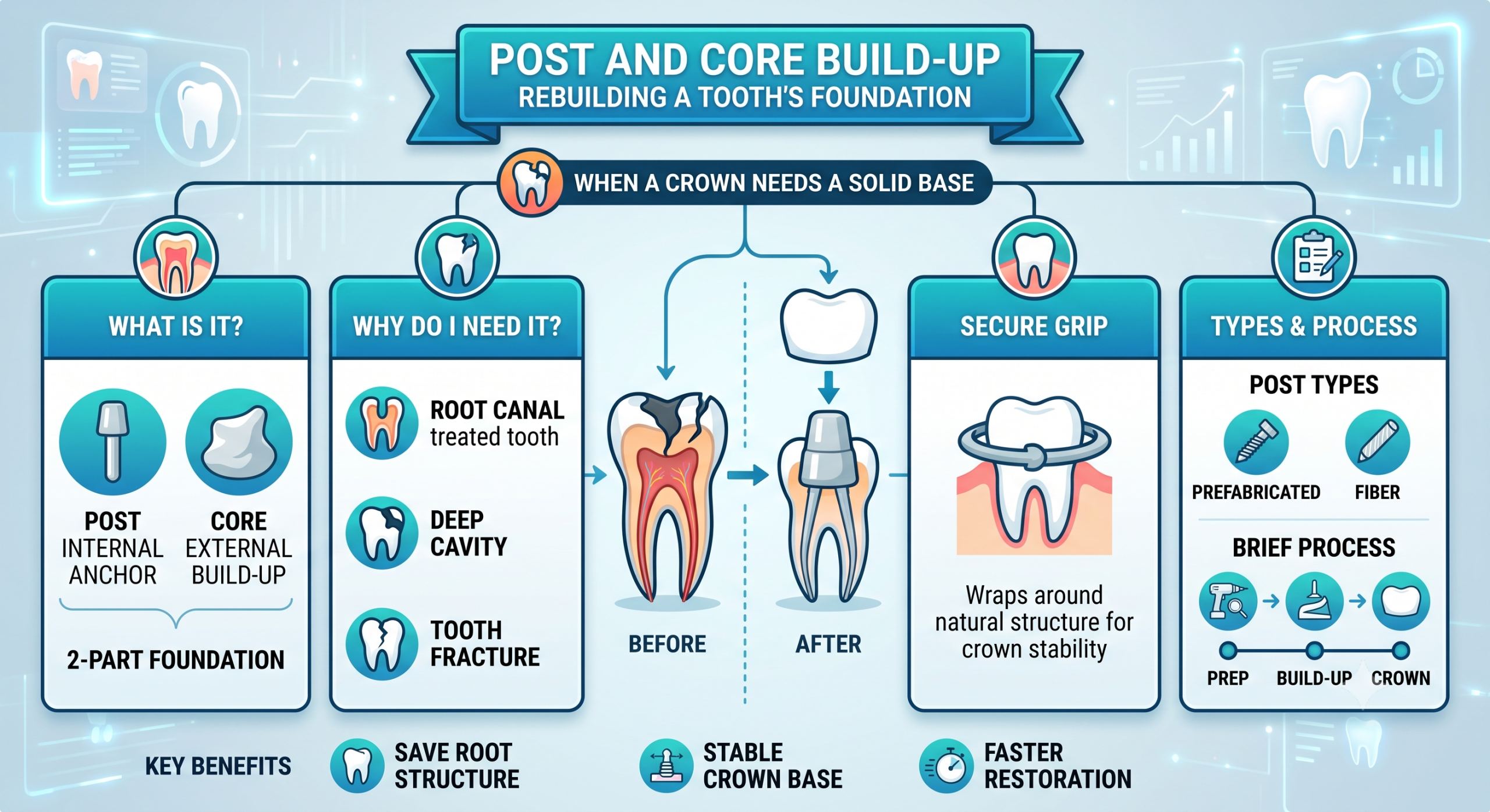 Post and Core Build-Up: Rebuilding a Tooth Before a Crown